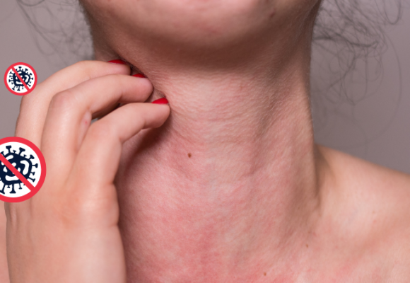 항산화, 항염증, 항알레르기 효능의 퀘르세틴 (quercetin,케르세틴) 