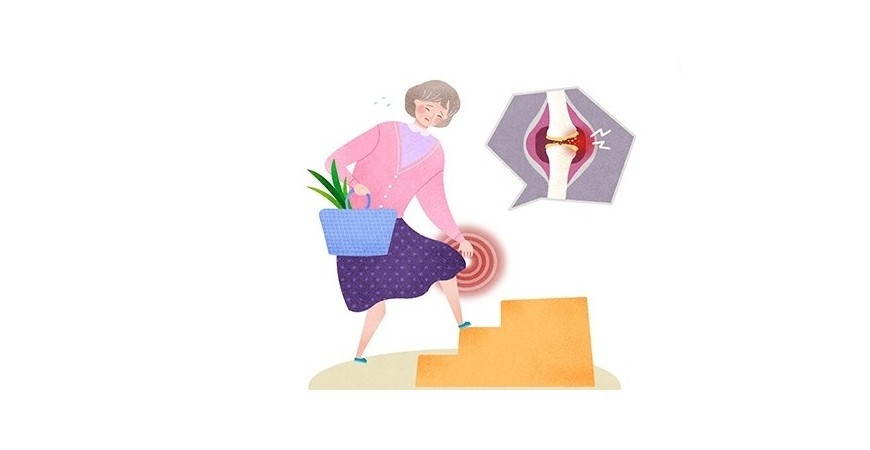 골다공증 막는 뼈건강 영양제, 칼슘 마그네슘 비타민D 3중 복합기능성 영양소