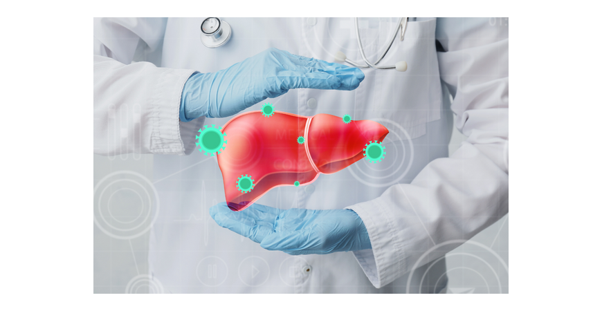  간 보호제, 밀크시슬 (milk thistle)은 간건강에 도움이 되나요?