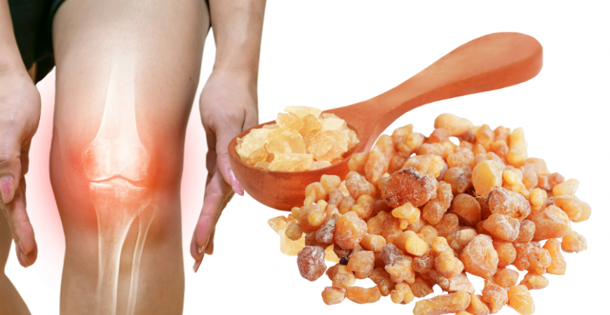 관절건강에 좋은 보스웰리아(Boswellia), 진짜 효능이 있을까?