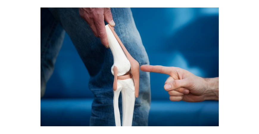 관절건강 영양제 MSM(식이유황) 효능과 부작용, 복용량