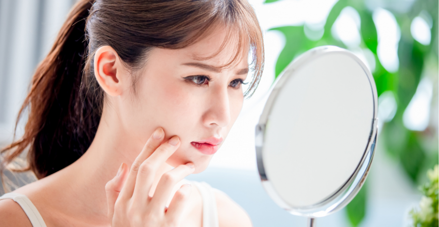 여름에 지성 피부 관리하는 방법