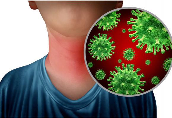 사망까지 이른다? 패혈성 인후염 원인, 증상, 치료법