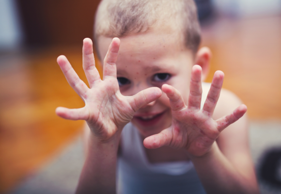 수족구병 예방: 아이를 보호하는 가장 효과적인 방법