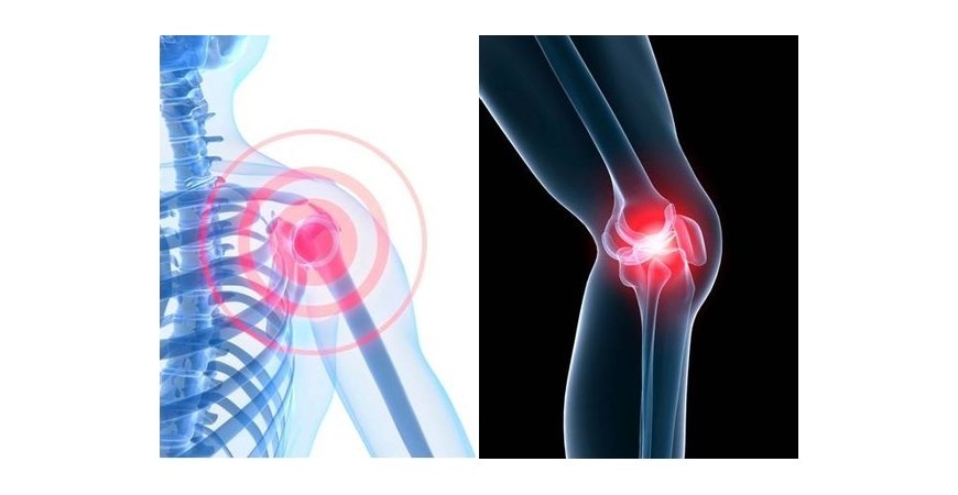 관절건강에 도움이 되는 영양제 비타민