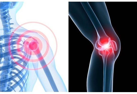 관절건강에 도움이 되는 영양제 비타민