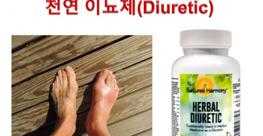 부종 빼고 신장에 좋은 천연 이뇨제(Diuretic)