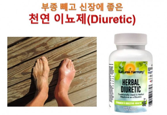 부종 빼고 신장에 좋은 천연 이뇨제(Diuretic)
