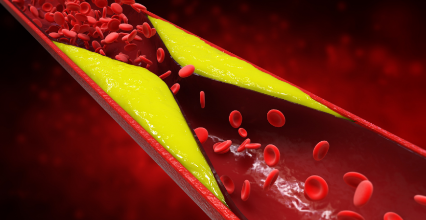 혈관 건강에 도움을 주는 영양제로 건강하게 오래살기