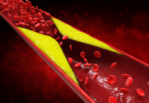 혈관 건강에 도움을 주는 영양제로 건강하게 오래살기